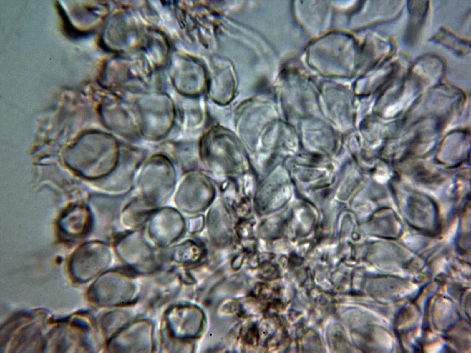 Microscopía de Marasmius epiphyllus - 10 - Pileipellis